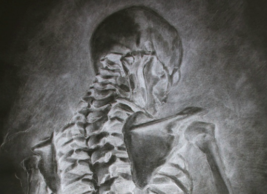 Skeletal by Darkthur